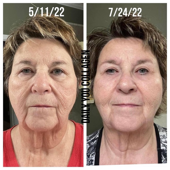 Daily•YOU collagène - 1 month 🍑 - Picture 6 of 7